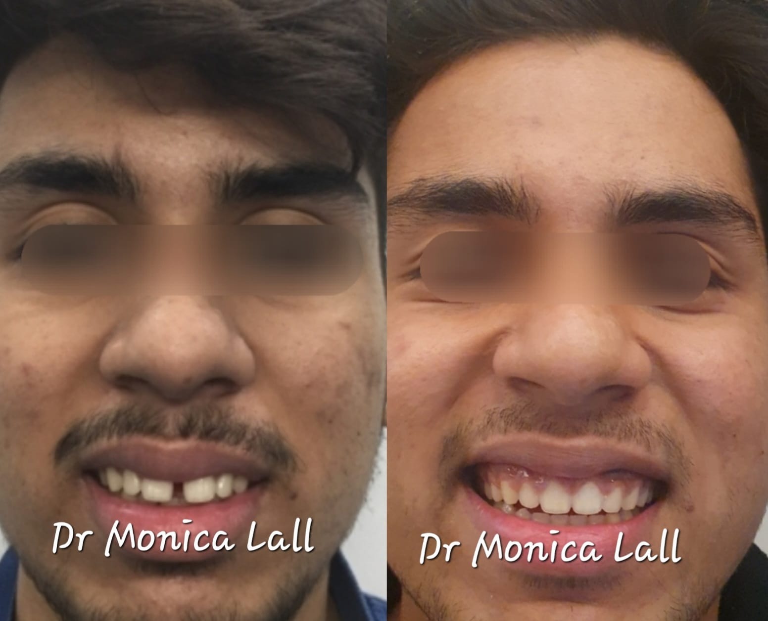 Dental Transformation